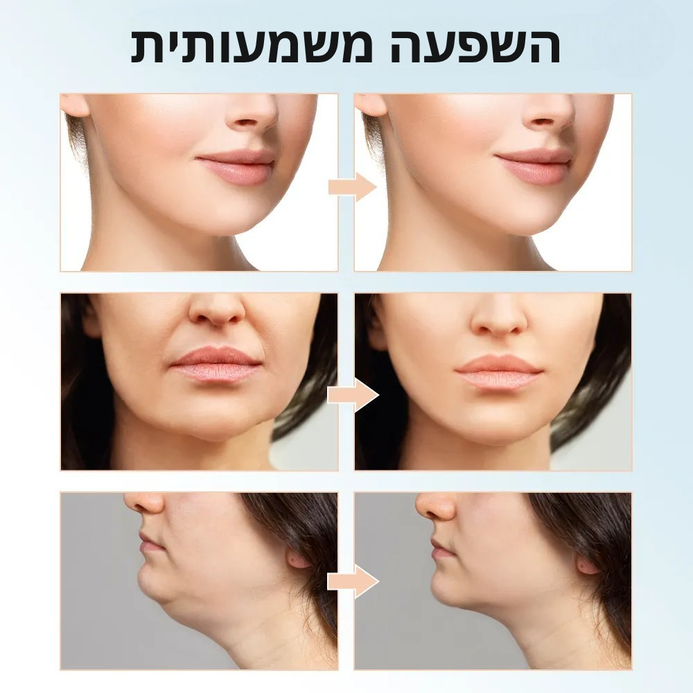 מכשיר יופי V להרמת פנים